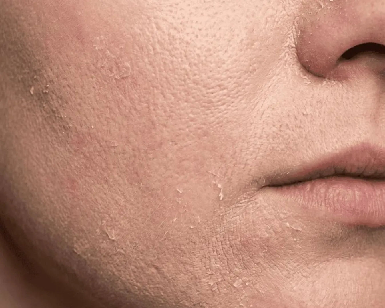 Dry Skin Regimen Set